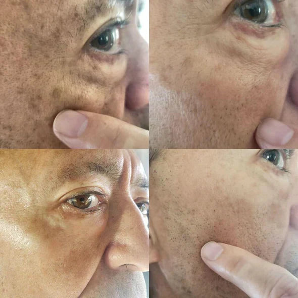 ✨Fast Dark Spot Remover-YAGOO™  Melanin Correcting Facial Serum(🔥Last Day Promotion 60% OFF)
