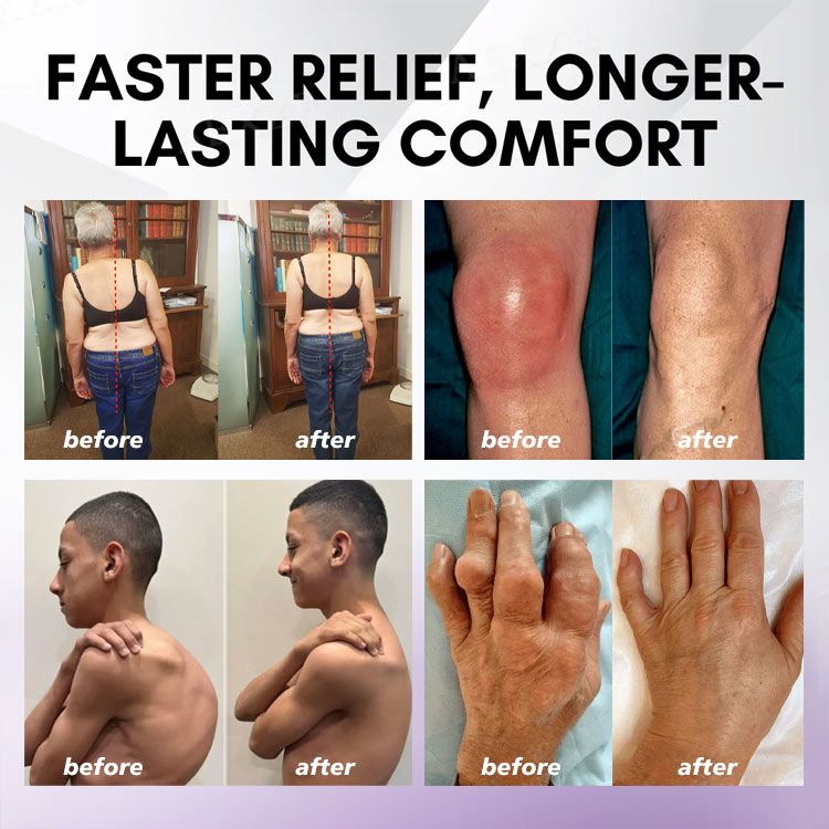 2026⏰Black Friday Limited-Time Special Offer: BUY 1 GET 1 FREE🔥SEAGRIL™ Turmeric & Emu Oil Arthritis Soothing Pain Relief Massage Gel 👨‍⚕️ American Osteopathic Association (AOA) Approved