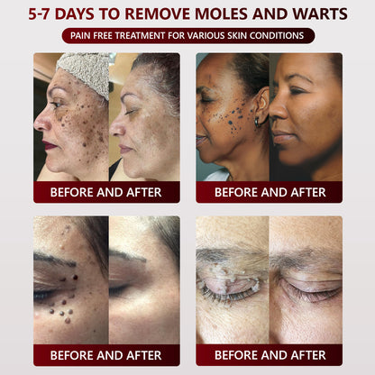 👑👑 SEAGRIL™ 𝐁𝐥𝗮𝐜𝐤 𝐑𝐢𝐜𝗲 𝐒𝐤𝗶𝐧 𝐑𝗲𝐩𝐚𝗶𝐫 𝐄𝐬𝐬𝗲𝐧𝐜𝐞 𝐂𝐫𝗲𝗮𝐦 ⚕️ 𝗠𝗛𝗥𝗔 𝗖𝗲𝗿𝘁𝗶𝗳𝗶𝗲𝗱 (𝗘𝗹𝗶𝗺𝗶𝗻𝗮𝘁𝗲𝘀 𝘄𝗮𝗿𝘁𝘀 𝗮𝗻𝗱 𝘀𝗸𝗶𝗻 𝘁𝗮𝗴𝘀, 𝗿𝗲𝗹𝗶𝗲𝘃𝗲𝘀 𝗽𝘀𝗼𝗿𝗶𝗮𝘀𝗶𝘀, 𝗶𝗺𝗽𝗿𝗼𝘃𝗲𝘀 𝗸𝗲𝗿𝗮𝘁𝗶𝗻 𝗯𝘂𝗶𝗹𝗱-𝘂𝗽 𝗮𝗻𝗱 𝗳𝗼𝗹𝗹𝗶𝗰𝘂𝗹𝗮𝗿 𝗸𝗲𝗿𝗮𝘁𝗶𝗻𝗶𝘇𝗮𝘁𝗶𝗼𝗻, 𝗳𝗮𝗱𝗲𝘀 𝗽𝗶𝗴𝗺𝗲𝗻𝘁𝗮𝘁𝗶𝗼𝗻, 𝘀𝘂𝗻 𝘀𝗽𝗼𝘁𝘀 & 𝗮𝗴𝗲 𝘀𝗽𝗼ts)