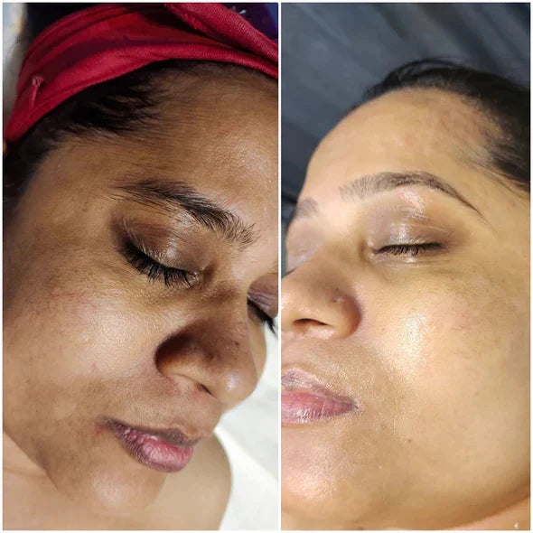 ✨Fast Dark Spot Remover-YAGOO™  Melanin Correcting Facial Serum(🔥Last Day Promotion 60% OFF)