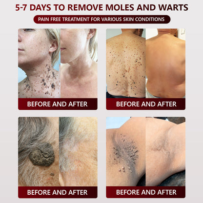 👑👑 SEAGRIL™ 𝐁𝐥𝗮𝐜𝐤 𝐑𝐢𝐜𝗲 𝐒𝐤𝗶𝐧 𝐑𝗲𝐩𝐚𝗶𝐫 𝐄𝐬𝐬𝗲𝐧𝐜𝐞 𝐂𝐫𝗲𝗮𝐦 ⚕️ 𝗠𝗛𝗥𝗔 𝗖𝗲𝗿𝘁𝗶𝗳𝗶𝗲𝗱 (𝗘𝗹𝗶𝗺𝗶𝗻𝗮𝘁𝗲𝘀 𝘄𝗮𝗿𝘁𝘀 𝗮𝗻𝗱 𝘀𝗸𝗶𝗻 𝘁𝗮𝗴𝘀, 𝗿𝗲𝗹𝗶𝗲𝘃𝗲𝘀 𝗽𝘀𝗼𝗿𝗶𝗮𝘀𝗶𝘀, 𝗶𝗺𝗽𝗿𝗼𝘃𝗲𝘀 𝗸𝗲𝗿𝗮𝘁𝗶𝗻 𝗯𝘂𝗶𝗹𝗱-𝘂𝗽 𝗮𝗻𝗱 𝗳𝗼𝗹𝗹𝗶𝗰𝘂𝗹𝗮𝗿 𝗸𝗲𝗿𝗮𝘁𝗶𝗻𝗶𝘇𝗮𝘁𝗶𝗼𝗻, 𝗳𝗮𝗱𝗲𝘀 𝗽𝗶𝗴𝗺𝗲𝗻𝘁𝗮𝘁𝗶𝗼𝗻, 𝘀𝘂𝗻 𝘀𝗽𝗼𝘁𝘀 & 𝗮𝗴𝗲 𝘀𝗽𝗼ts)