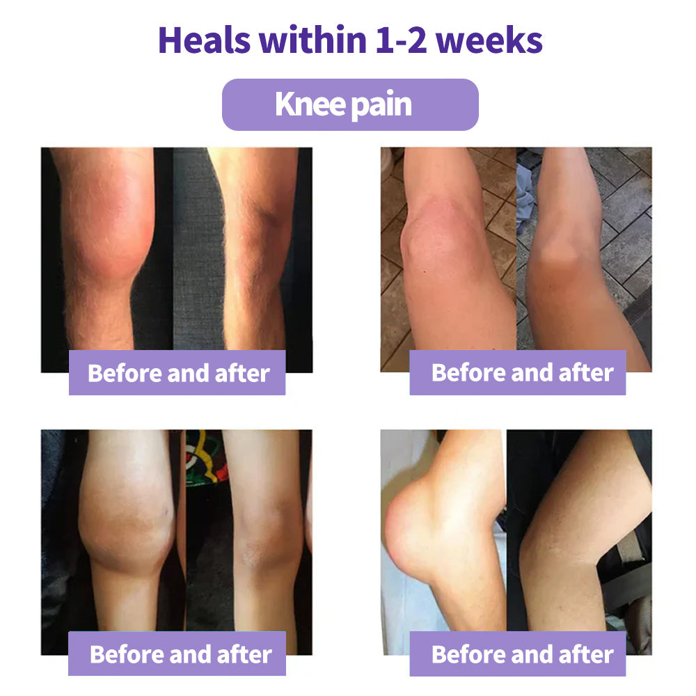 2026⏰Black Friday Limited-Time Special Offer: BUY 1 GET 1 FREE🔥SEAGRIL™ Turmeric & Emu Oil Arthritis Soothing Pain Relief Massage Gel 👨‍⚕️ American Osteopathic Association (AOA) Approved