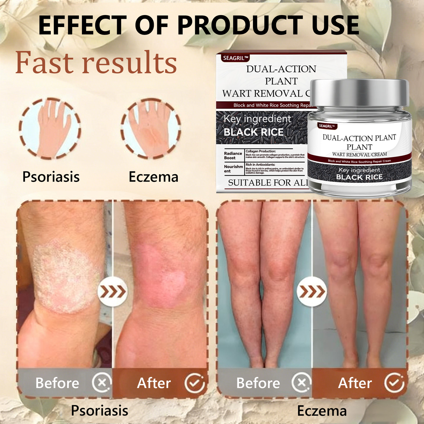 👑👑 SEAGRIL™ 𝐁𝐥𝗮𝐜𝐤 𝐑𝐢𝐜𝗲 𝐒𝐤𝗶𝐧 𝐑𝗲𝐩𝐚𝗶𝐫 𝐄𝐬𝐬𝗲𝐧𝐜𝐞 𝐂𝐫𝗲𝗮𝐦 ⚕️ 𝗠𝗛𝗥𝗔 𝗖𝗲𝗿𝘁𝗶𝗳𝗶𝗲𝗱 (𝗘𝗹𝗶𝗺𝗶𝗻𝗮𝘁𝗲𝘀 𝘄𝗮𝗿𝘁𝘀 𝗮𝗻𝗱 𝘀𝗸𝗶𝗻 𝘁𝗮𝗴𝘀, 𝗿𝗲𝗹𝗶𝗲𝘃𝗲𝘀 𝗽𝘀𝗼𝗿𝗶𝗮𝘀𝗶𝘀, 𝗶𝗺𝗽𝗿𝗼𝘃𝗲𝘀 𝗸𝗲𝗿𝗮𝘁𝗶𝗻 𝗯𝘂𝗶𝗹𝗱-𝘂𝗽 𝗮𝗻𝗱 𝗳𝗼𝗹𝗹𝗶𝗰𝘂𝗹𝗮𝗿 𝗸𝗲𝗿𝗮𝘁𝗶𝗻𝗶𝘇𝗮𝘁𝗶𝗼𝗻, 𝗳𝗮𝗱𝗲𝘀 𝗽𝗶𝗴𝗺𝗲𝗻𝘁𝗮𝘁𝗶𝗼𝗻, 𝘀𝘂𝗻 𝘀𝗽𝗼𝘁𝘀 & 𝗮𝗴𝗲 𝘀𝗽𝗼ts)