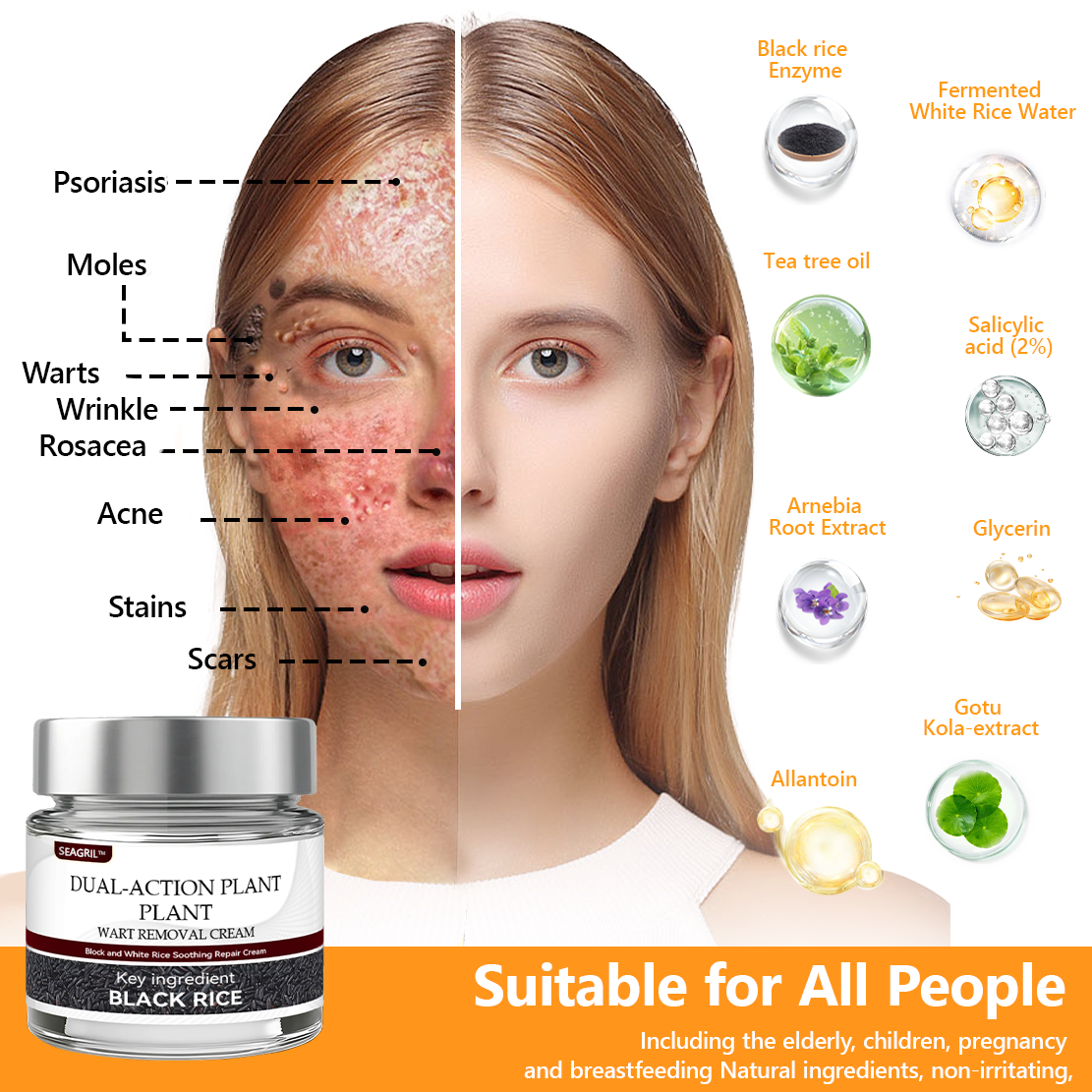 👑👑 SEAGRIL™ 𝐁𝐥𝗮𝐜𝐤 𝐑𝐢𝐜𝗲 𝐒𝐤𝗶𝐧 𝐑𝗲𝐩𝐚𝗶𝐫 𝐄𝐬𝐬𝗲𝐧𝐜𝐞 𝐂𝐫𝗲𝗮𝐦 ⚕️ 𝗠𝗛𝗥𝗔 𝗖𝗲𝗿𝘁𝗶𝗳𝗶𝗲𝗱 (𝗘𝗹𝗶𝗺𝗶𝗻𝗮𝘁𝗲𝘀 𝘄𝗮𝗿𝘁𝘀 𝗮𝗻𝗱 𝘀𝗸𝗶𝗻 𝘁𝗮𝗴𝘀, 𝗿𝗲𝗹𝗶𝗲𝘃𝗲𝘀 𝗽𝘀𝗼𝗿𝗶𝗮𝘀𝗶𝘀, 𝗶𝗺𝗽𝗿𝗼𝘃𝗲𝘀 𝗸𝗲𝗿𝗮𝘁𝗶𝗻 𝗯𝘂𝗶𝗹𝗱-𝘂𝗽 𝗮𝗻𝗱 𝗳𝗼𝗹𝗹𝗶𝗰𝘂𝗹𝗮𝗿 𝗸𝗲𝗿𝗮𝘁𝗶𝗻𝗶𝘇𝗮𝘁𝗶𝗼𝗻, 𝗳𝗮𝗱𝗲𝘀 𝗽𝗶𝗴𝗺𝗲𝗻𝘁𝗮𝘁𝗶𝗼𝗻, 𝘀𝘂𝗻 𝘀𝗽𝗼𝘁𝘀 & 𝗮𝗴𝗲 𝘀𝗽𝗼ts)