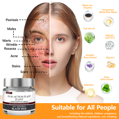 👑👑 SEAGRIL™ 𝐁𝐥𝗮𝐜𝐤 𝐑𝐢𝐜𝗲 𝐒𝐤𝗶𝐧 𝐑𝗲𝐩𝐚𝗶𝐫 𝐄𝐬𝐬𝗲𝐧𝐜𝐞 𝐂𝐫𝗲𝗮𝐦 ⚕️ 𝗠𝗛𝗥𝗔 𝗖𝗲𝗿𝘁𝗶𝗳𝗶𝗲𝗱 (𝗘𝗹𝗶𝗺𝗶𝗻𝗮𝘁𝗲𝘀 𝘄𝗮𝗿𝘁𝘀 𝗮𝗻𝗱 𝘀𝗸𝗶𝗻 𝘁𝗮𝗴𝘀, 𝗿𝗲𝗹𝗶𝗲𝘃𝗲𝘀 𝗽𝘀𝗼𝗿𝗶𝗮𝘀𝗶𝘀, 𝗶𝗺𝗽𝗿𝗼𝘃𝗲𝘀 𝗸𝗲𝗿𝗮𝘁𝗶𝗻 𝗯𝘂𝗶𝗹𝗱-𝘂𝗽 𝗮𝗻𝗱 𝗳𝗼𝗹𝗹𝗶𝗰𝘂𝗹𝗮𝗿 𝗸𝗲𝗿𝗮𝘁𝗶𝗻𝗶𝘇𝗮𝘁𝗶𝗼𝗻, 𝗳𝗮𝗱𝗲𝘀 𝗽𝗶𝗴𝗺𝗲𝗻𝘁𝗮𝘁𝗶𝗼𝗻, 𝘀𝘂𝗻 𝘀𝗽𝗼𝘁𝘀 & 𝗮𝗴𝗲 𝘀𝗽𝗼ts)