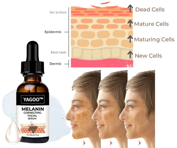 ✨Fast Dark Spot Remover-YAGOO™  Melanin Correcting Facial Serum(🔥Last Day Promotion 60% OFF)