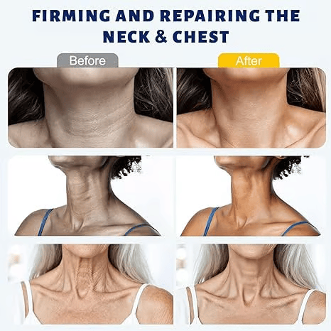 ✨ Tiworld Instant Neck Lift Cream  — 🧴 Infused with Retinol & Hyaluronic Acid | Firms the Neck, Reduces Wrinkles & Double Chin
