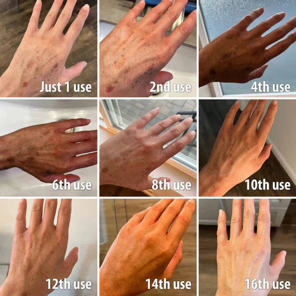 ✨Fast Dark Spot Remover-YAGOO™  Melanin Correcting Facial Serum(🔥Last Day Promotion 60% OFF)