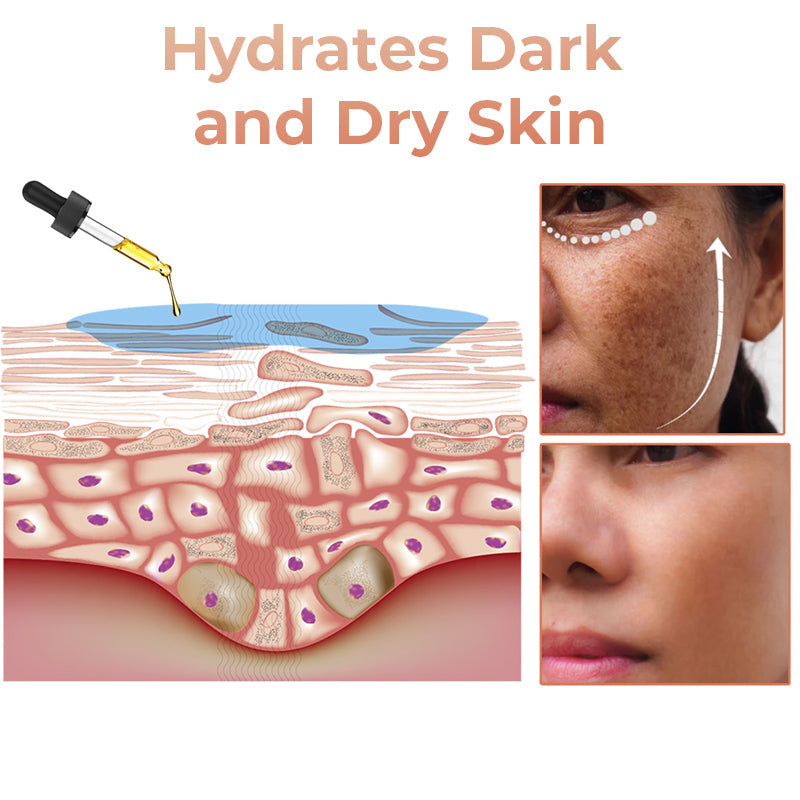 ✨Fast Dark Spot Remover-YAGOO™  Melanin Correcting Facial Serum(🔥Last Day Promotion 60% OFF)